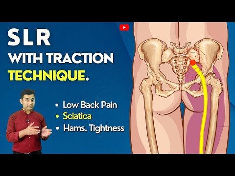 HEADACHE HOME EXERCISE ATLAS C1 PUSH AND ROTATE TECHNIQUE MOBILIZATION WITH MOVEMENT THERAPY