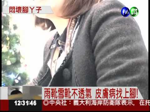 靴子穿太久! 腳趾頭紅腫長濕疹