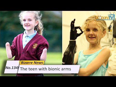 No. 134, Bizarre News : The teen with bionic arms. (ISL)