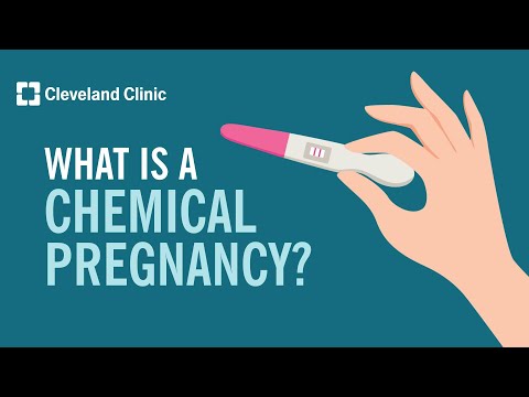 Chemical Pregnancy: Causes, Symptoms & Treatment