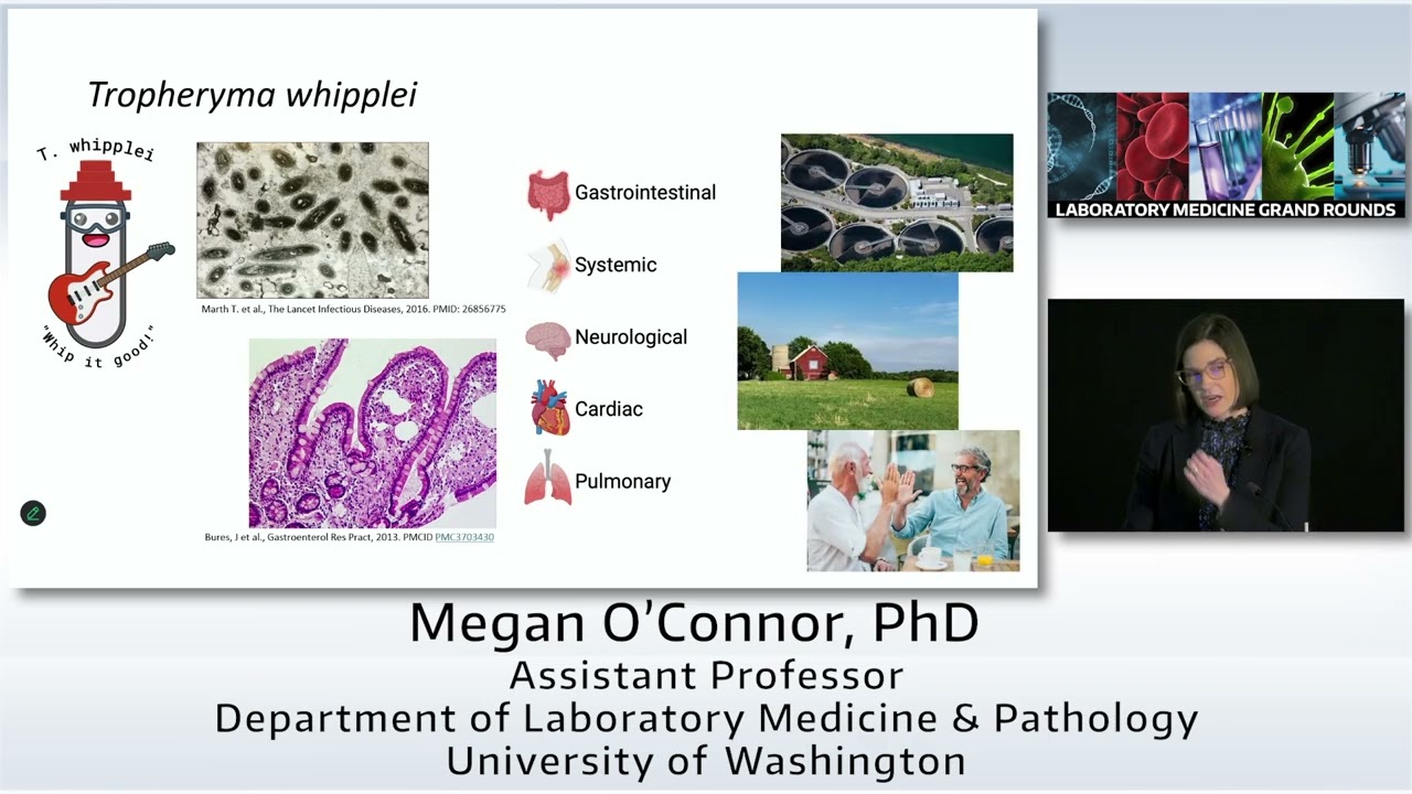 Unveiling Microbial Dominance of the Pulmonary Microbiome