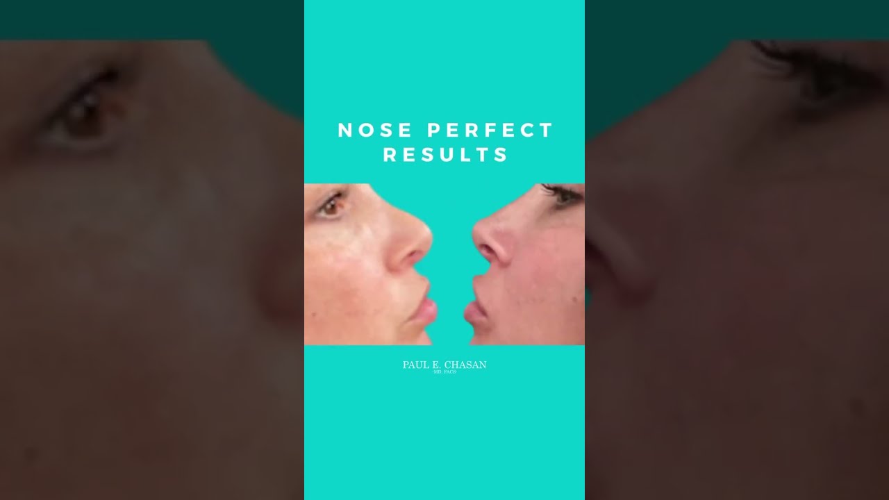 Can You Believe This Nose Perfect Success Story?