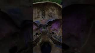 Dr Medhat-Skull 1