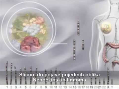Hematološke maligne bolesti- Limfovi- Uzroci i faktori rizika