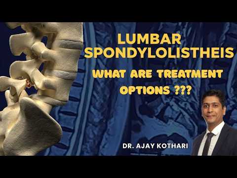 Thumbnail of video - Lumbar spondylolisthesis: what are treatment options| Dr. Ajay Kothari