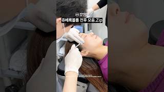 쥬베룩 볼륨 전후 모음ZIP.