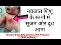 Neonatal Breast Enlargement Milk Production नवजात शिशू के स्तनों �