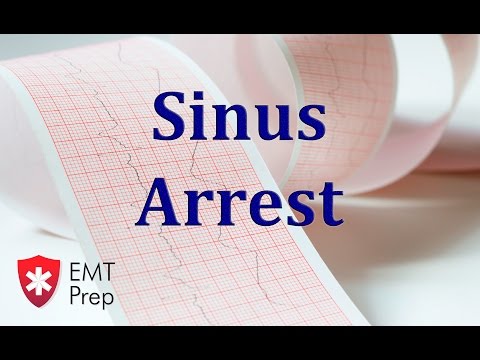 Sinus Arrest ECG - EMTprep.com