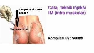 Download lagu Sop, teknik injeksi IM by setiadi mp3 Download lagu Sop, teknik injeksi IM by setiadi mp3