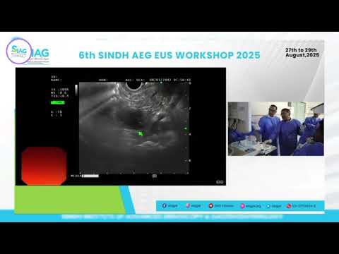 AEG -EUS workshop || 2025 At Siag civil hospital Karachi part 9