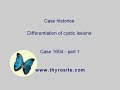Differentiation Of Cystic Lesions Case 1604 Part 1