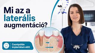 Laterális augmentáció