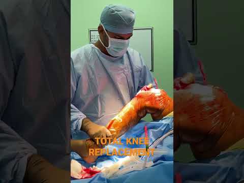 Total Knee REPLACEMENT ORTHOPAEDICS| Dr. Deepak Koli