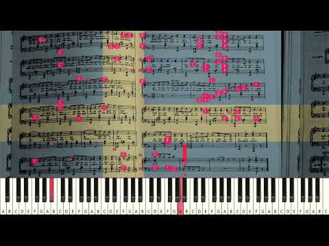 Karl Wehle: Tändsticksparaden [Sight-read]