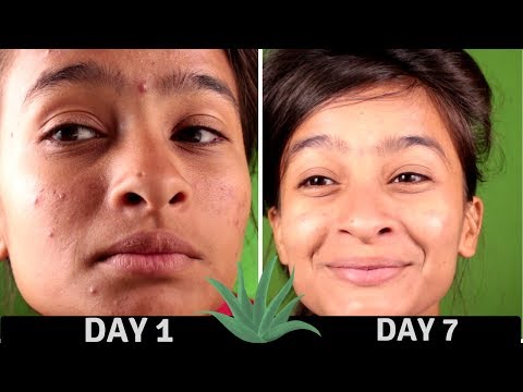 Kung paano gamutin ang kuko halamang-singaw mula sa mga itlog at suka Kung paano ituring ang walang laman na toenails