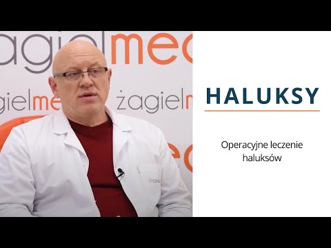 Silne stłuczenie kości na stopie Leczyć guzki na piechotę blisko dużego palca
