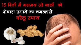 15 दिनों में असमय उड़े बालों को दोबारा उगाने का चमत्कारी घरेलू उपाय  baldness cure in 15 days