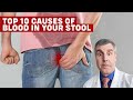 The Major Causes Of Blood In Your Stool