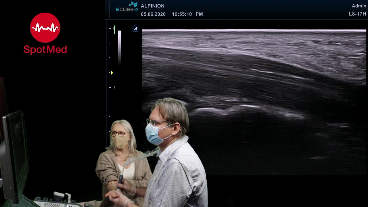 USG nadgarstka — techniki badania