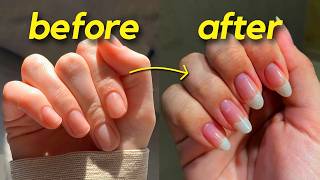 how ANYONE can grow long natural nails FAST