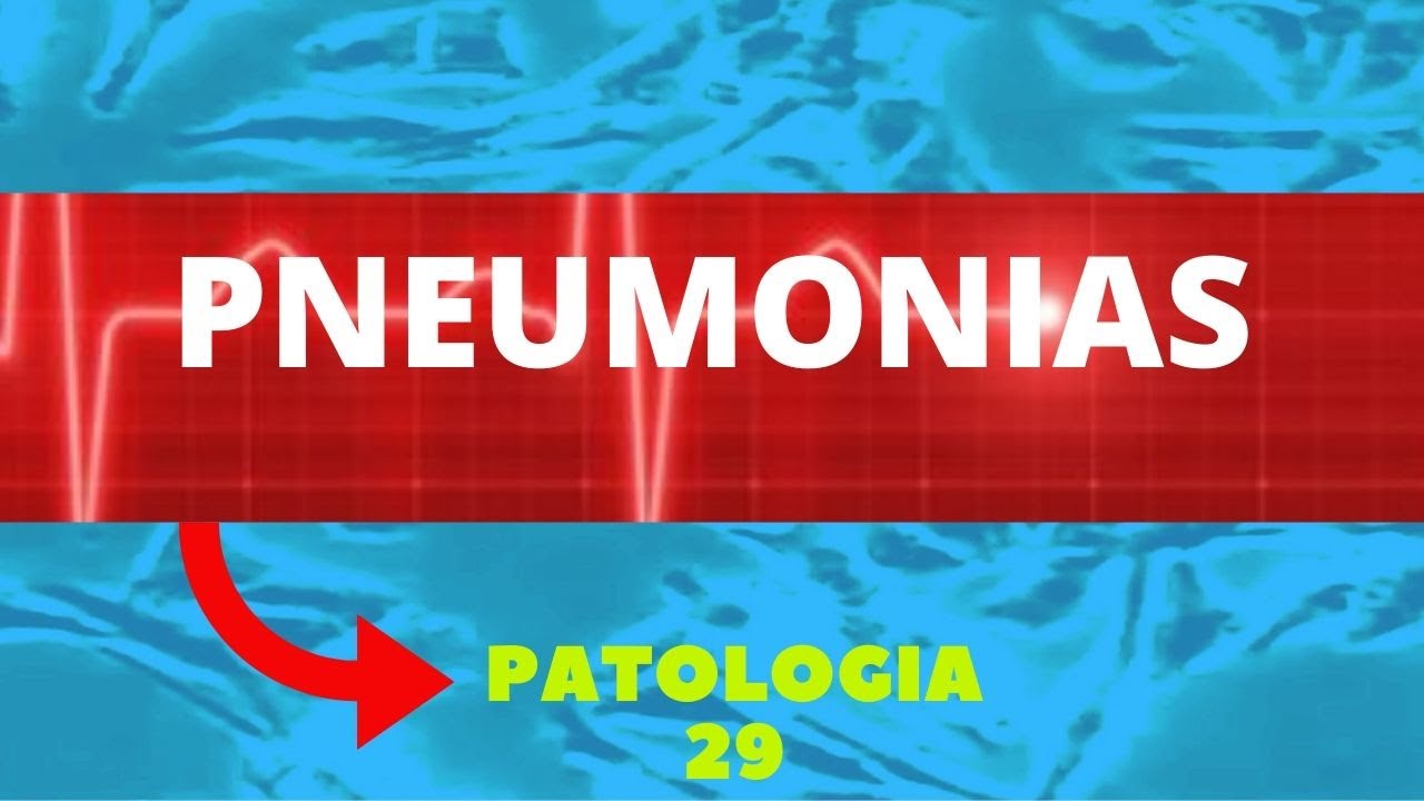 PNEUMONIAS - PATOLOGIA 29