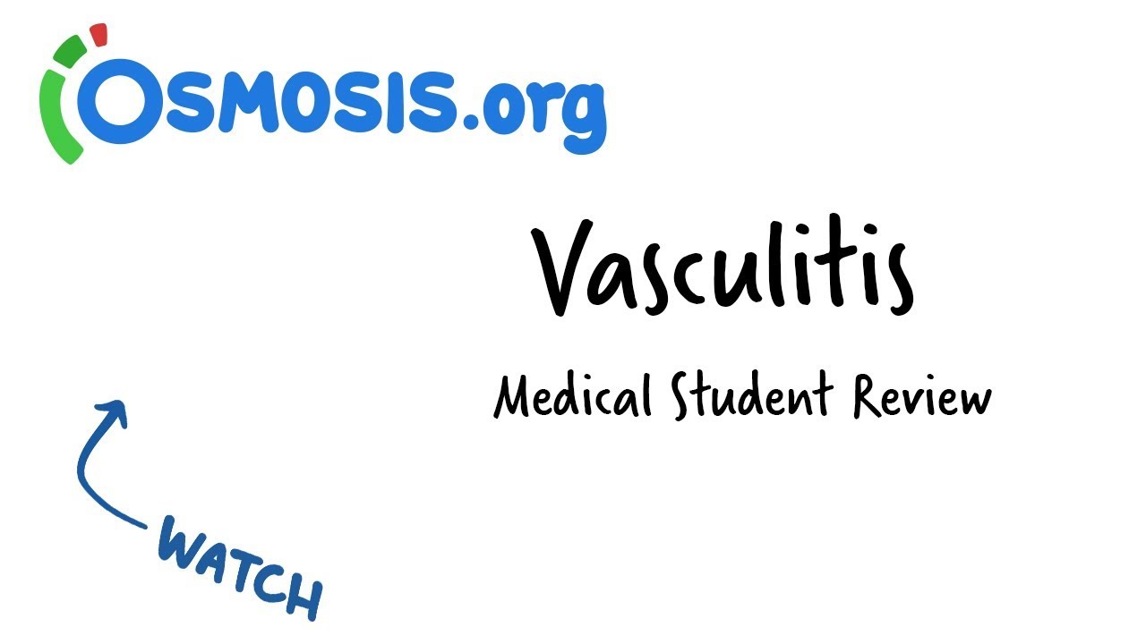Vasculitis | Clinical Presentation