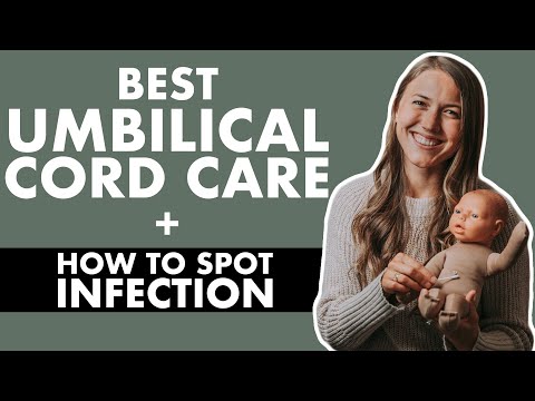HOW TO TAKE CARE OF NEWBORN BELLY BUTTON | Umbilical Cord Care | Infected Umbilical Cord