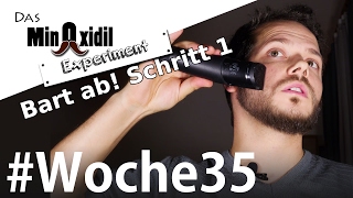 Das Minoxidil Experiment #Woche35 Der Bart kommt ab Stufe1