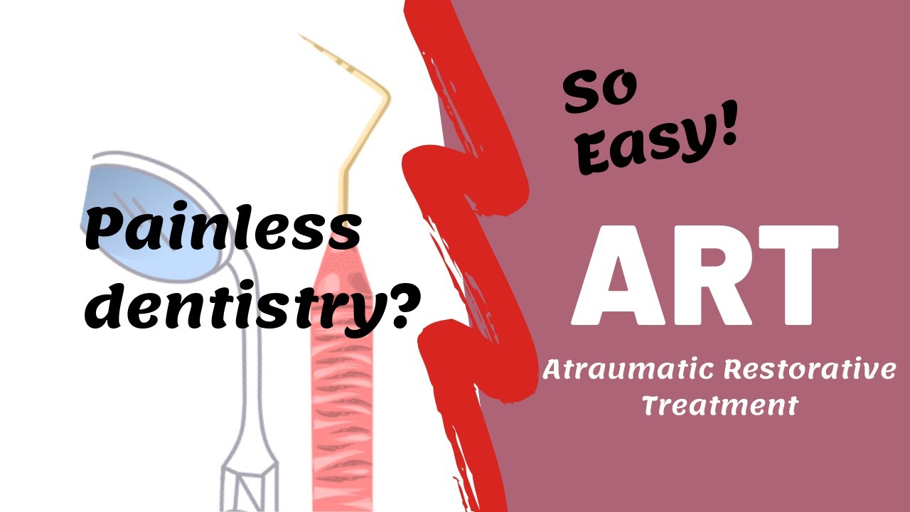 DENTAL PROCEDURES | The art behind ART | Atraumatic Restorative Treatment