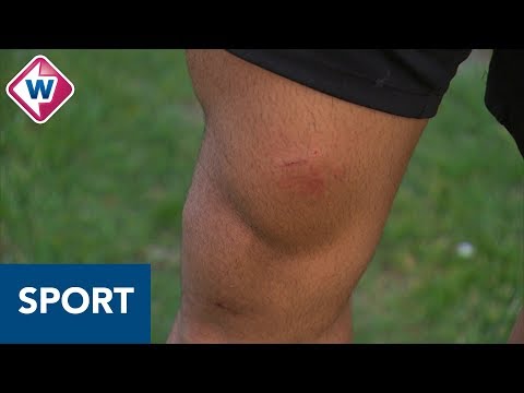 FC Lisse-speler Martin van Eeuwijk doet 'Suarezje': bijt tegenstander in been