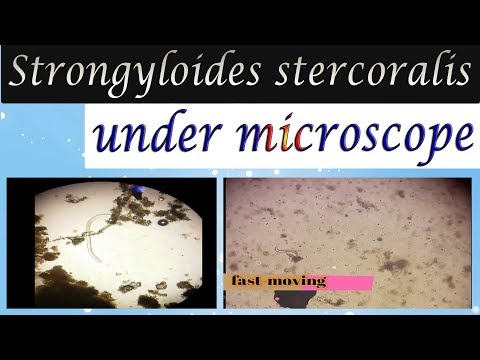 strongyloidosis, ahol elterjedt