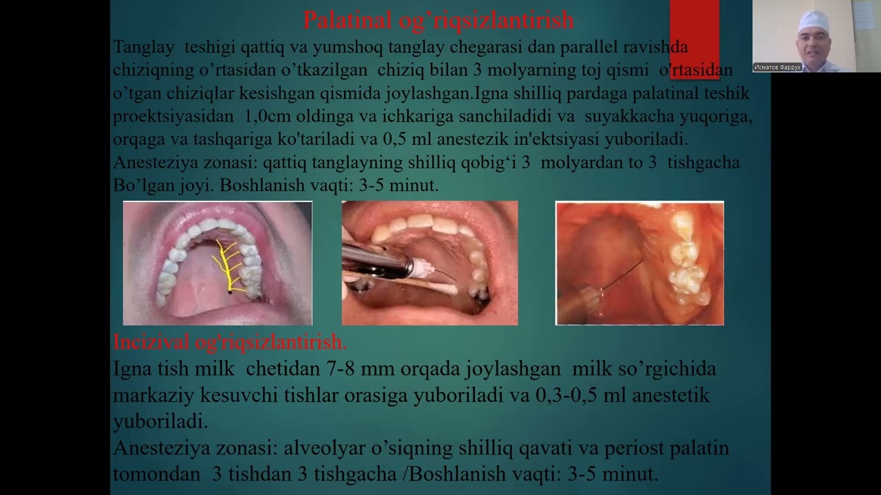Mutaxassislikka kirish.  Bolalarda og‘riqsizlantirishning xususiyatlari