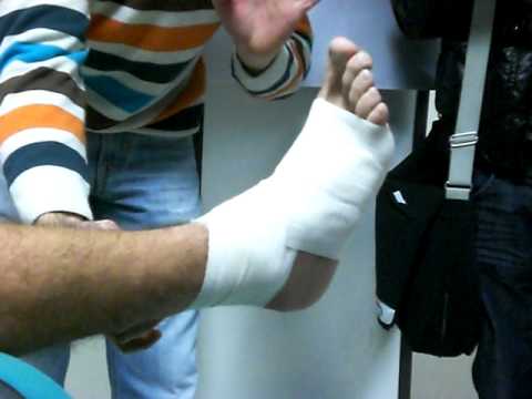 Trattamento medico Bubnovskaya Spine Clinic Spalla pregiudizio comune di caduta