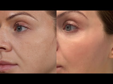 Kosmyq Pigment Correction Peel