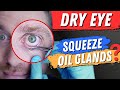 Should You Do Meibomian Gland Expression At Home For Dry Eye?