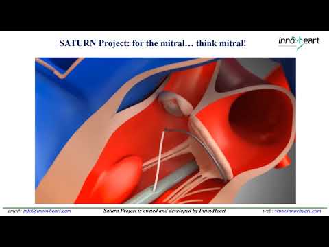 InnovHeart  Transapical Technology