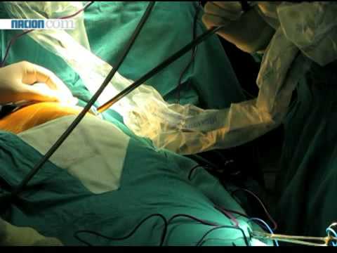 Nueva cirugía  permite intervenir tórax sin romper el esternón