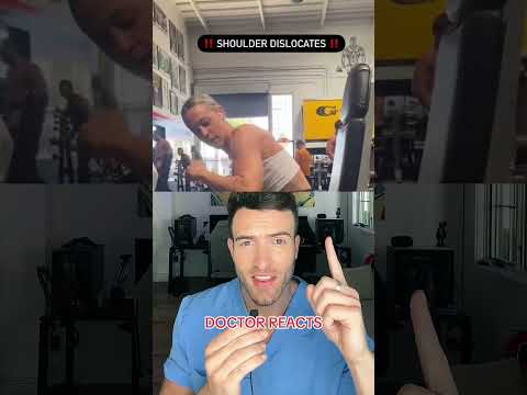 Shoulder dislocation caught on video #doctor