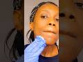 Lactic Acid Facial Peel Youtubeshorts Shebeauty Beauty Kbeauty Skincare Skintreatment
