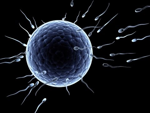 Tipi di calcificazioni nella prostata Candele per adenoma prostatico con celidonia