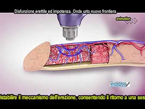Recensione ingrandire il vostro pene sul forum H aumento membro
