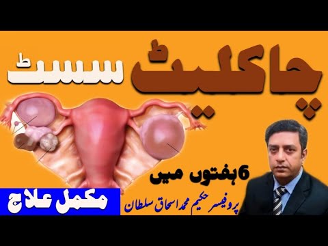 CHOCOLATE CYST' causes & treatment(چاکلیٹ سسٹ کی وجوہات و علاج)By Prof-Hak Ishaque Sultan.