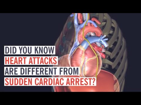 The Difference Between a Heart Attack and Cardiac Arrest