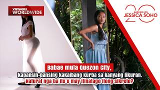 Download lagu Babae mula Quezon City, kapansin-pansing kakaibang kurba sa likuran | Kapuso Mo, Jessica Soho mp3