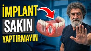 İmplant yaptıranlara KİMSE bunu söylemedi
