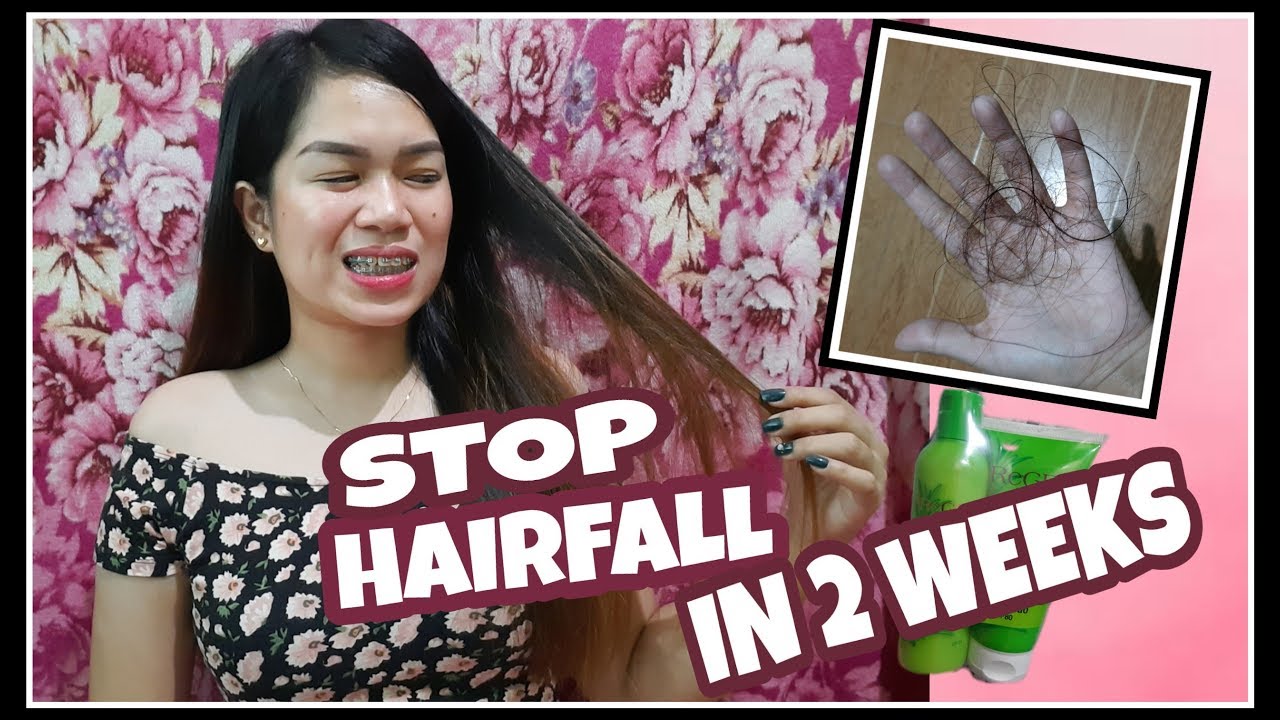 Putar video STOP HAIRFALL IN 2 WEEKS | NALALAGAS NA BUHOK | CAUSES, SOLUTION & PREVENTION |PREGROE| VLOG #009 sekarang STOP HAIRFALL IN 2 WEEKS | NALALAGAS NA BUHOK | CAUSES, SOLUTION & PREVENTION |PREGROE| VLOG #009