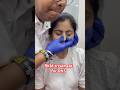 RKM Treatment For DNS Chiropractor Drrajneeshkant RKM