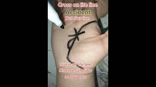 Download lagu Cross on life line Accident #palmistry #palmreadings #life #palmist #accident #hand #survive mp3