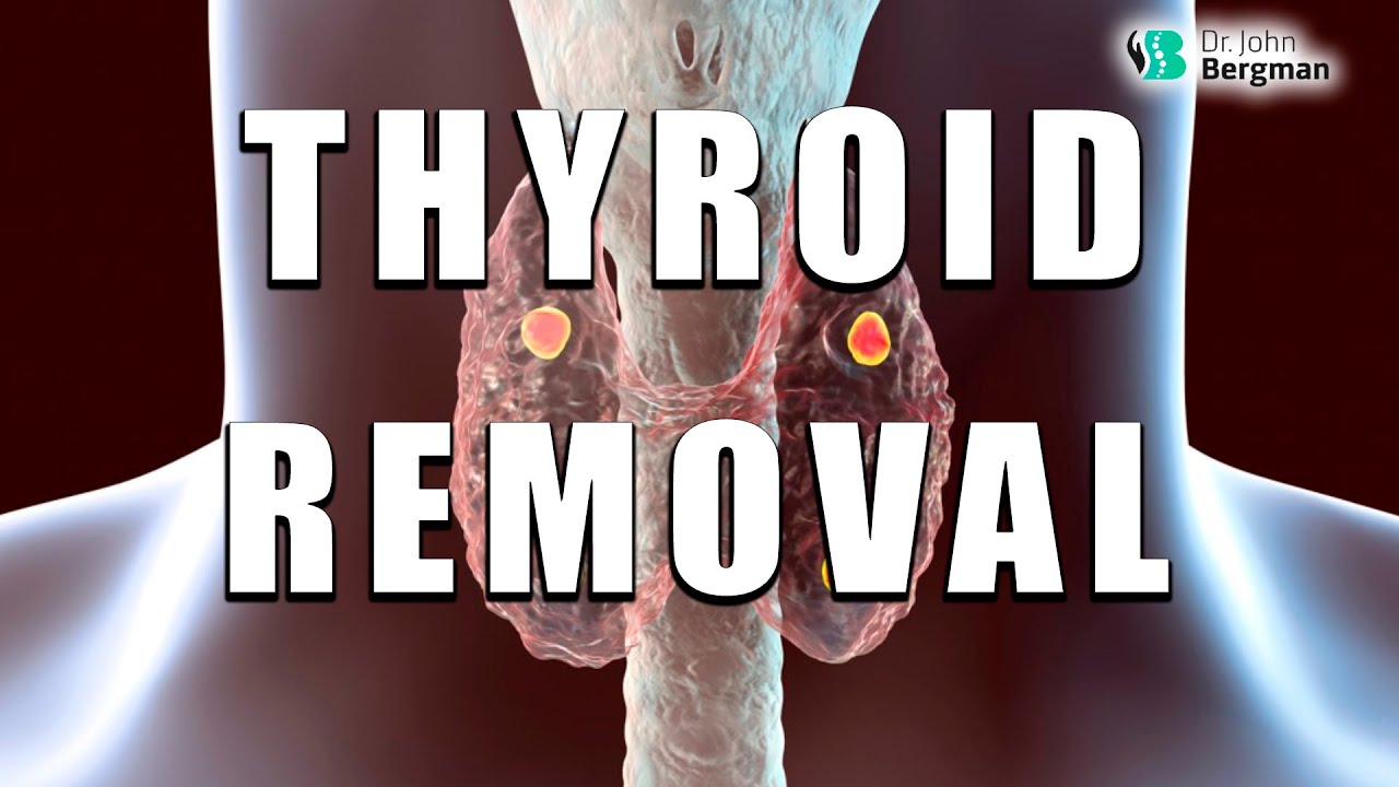 Thyroid Removal - YouTube