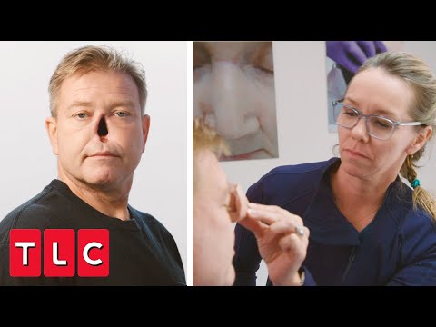 Jay Gets His New Prosthetic Nose | Body Parts
